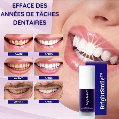 BrightSmile - Dentifrice de Blanchiment Dentaire